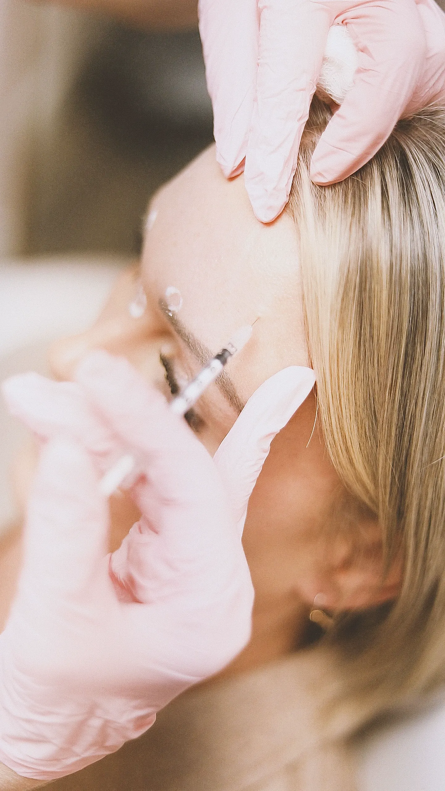 Dermal Fillers